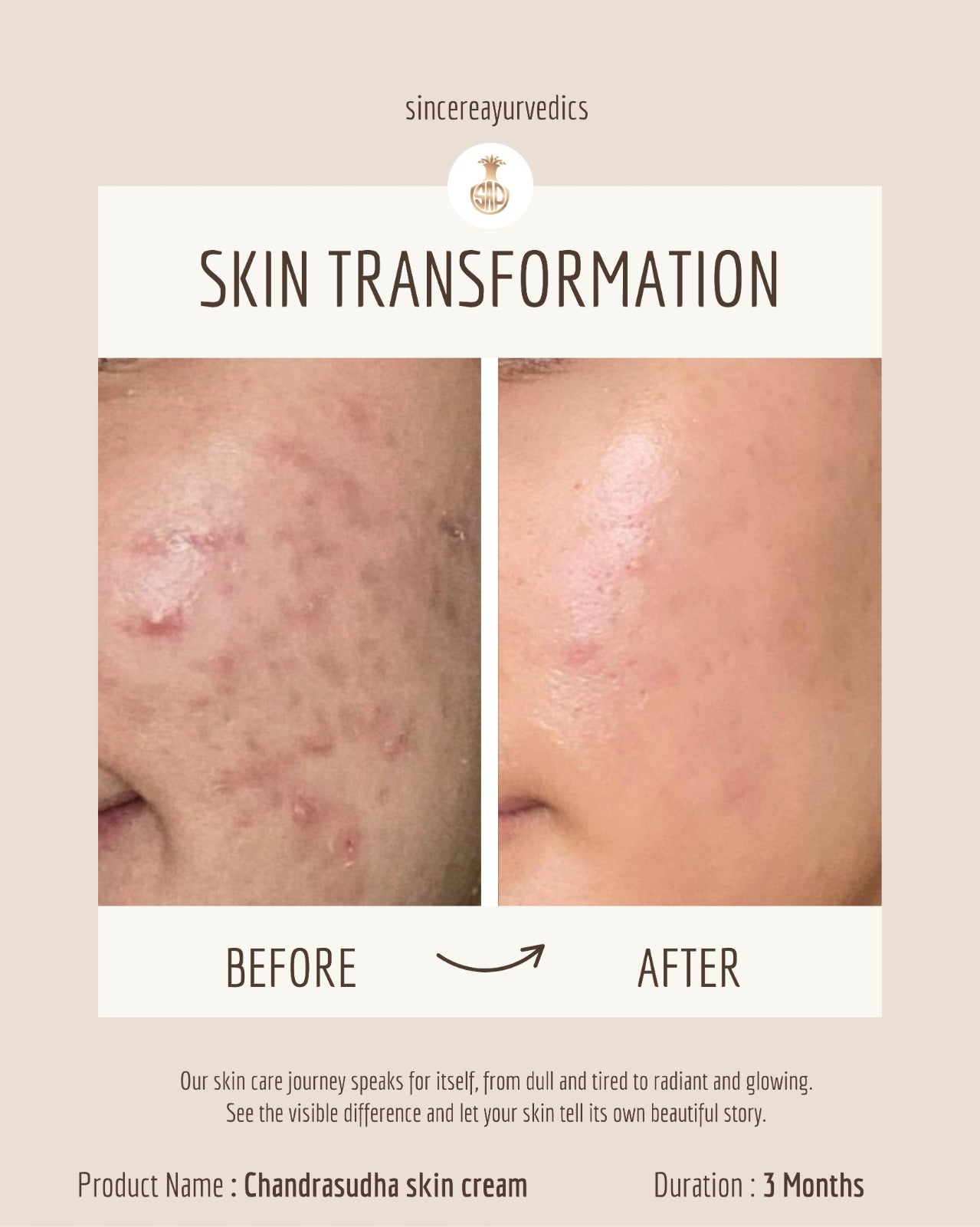 Skin Nourishing Oil – 100% Natural & Chemical-Free | 100ml
