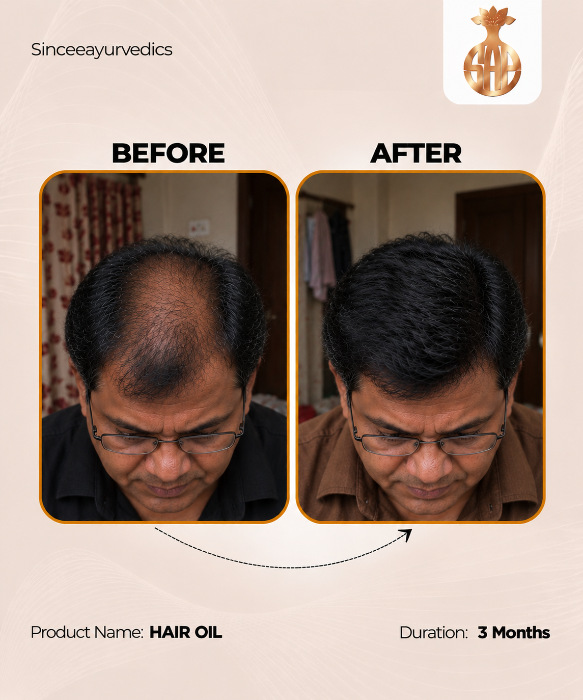 Chandrasudha Ayurvedic Regrow + Strengthen Hair Kit