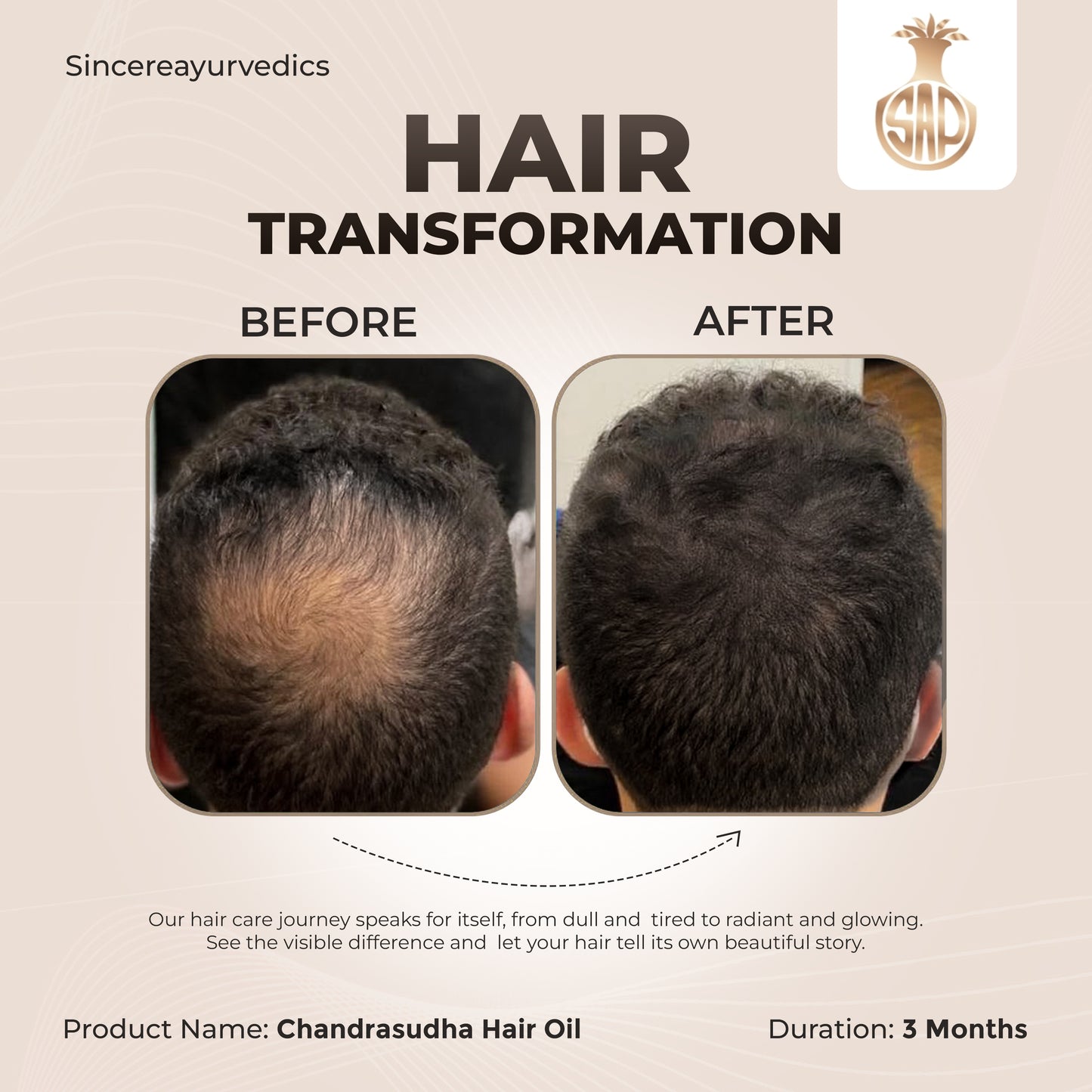 Chandrasudha Hair Care Duo Pack