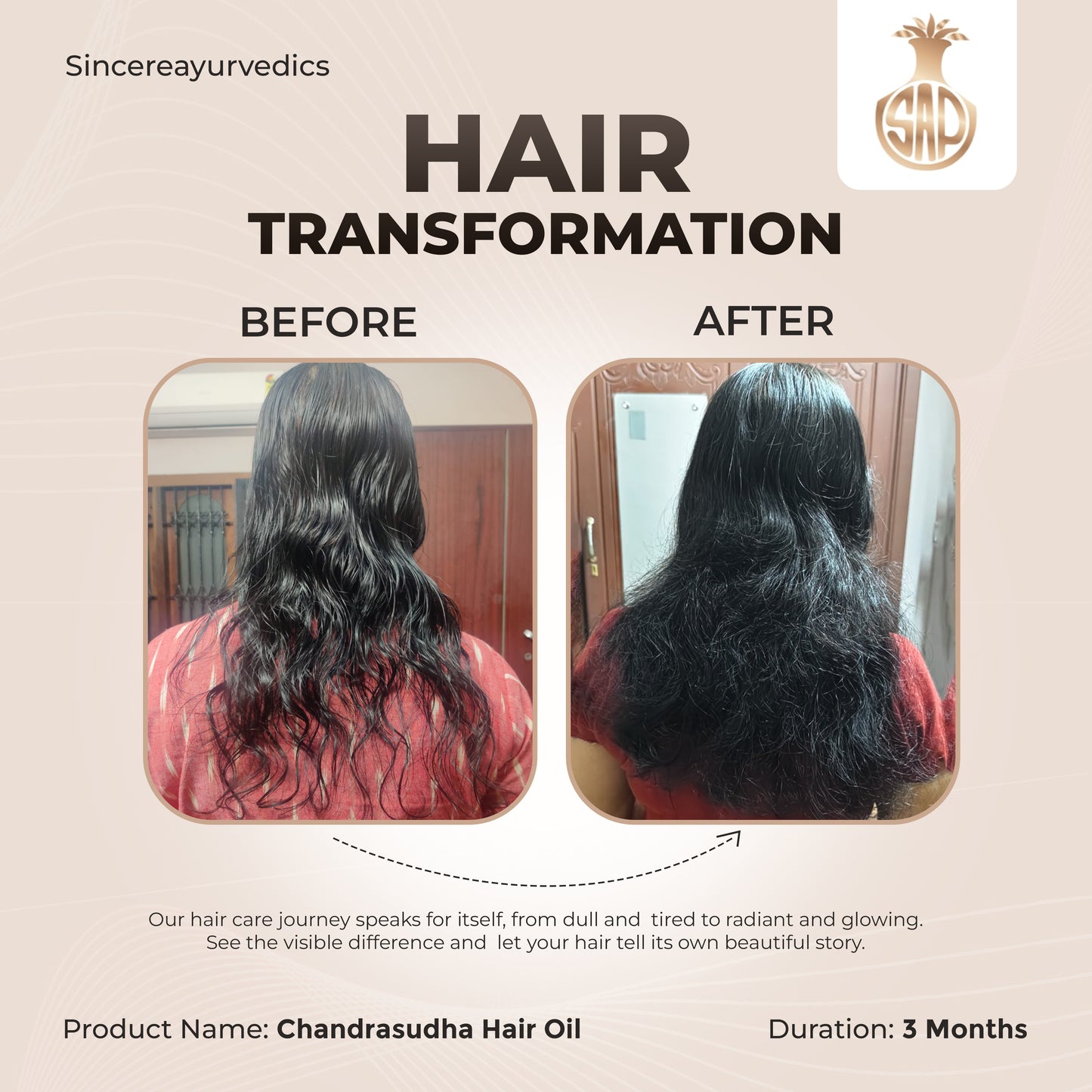 Chandrasudha Ayurvedic Regrow + Strengthen Hair Kit