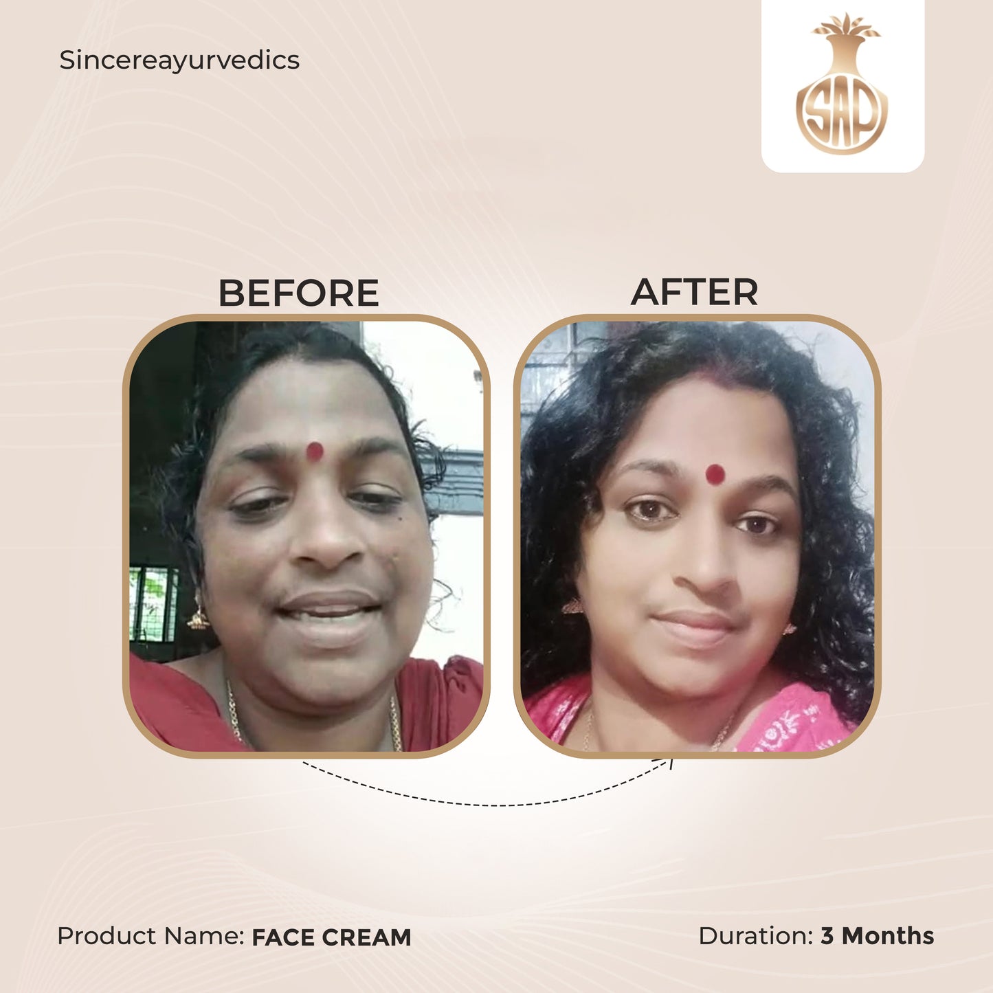 Chandrasudha Skin Care Duo