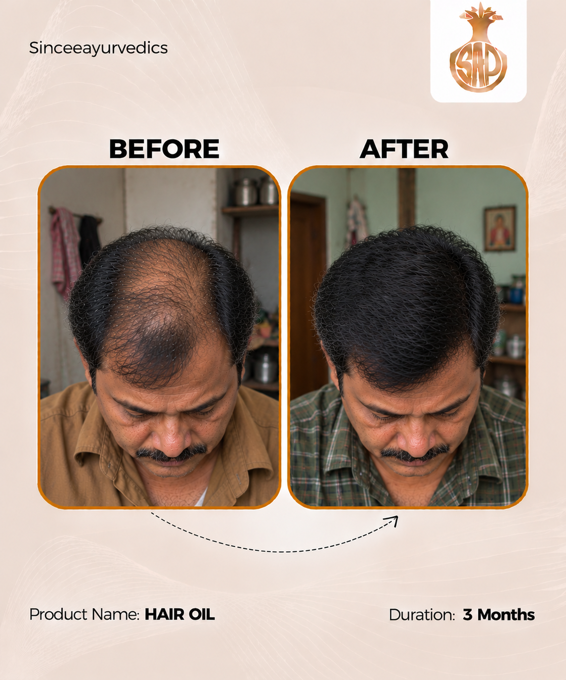 Chandrasudha Ayurvedic Regrow + Strengthen Hair Kit