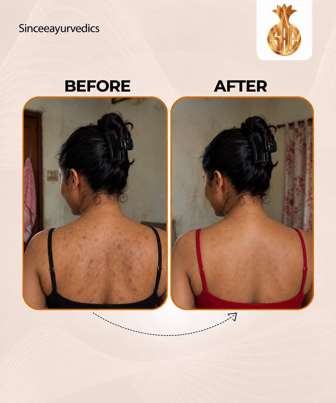 Skin Nourishing Oil – 100% Natural & Chemical-Free | 100ml