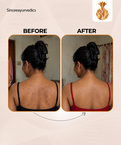 Skin Nourishing Oil – 100% Natural & Chemical-Free | 100ml