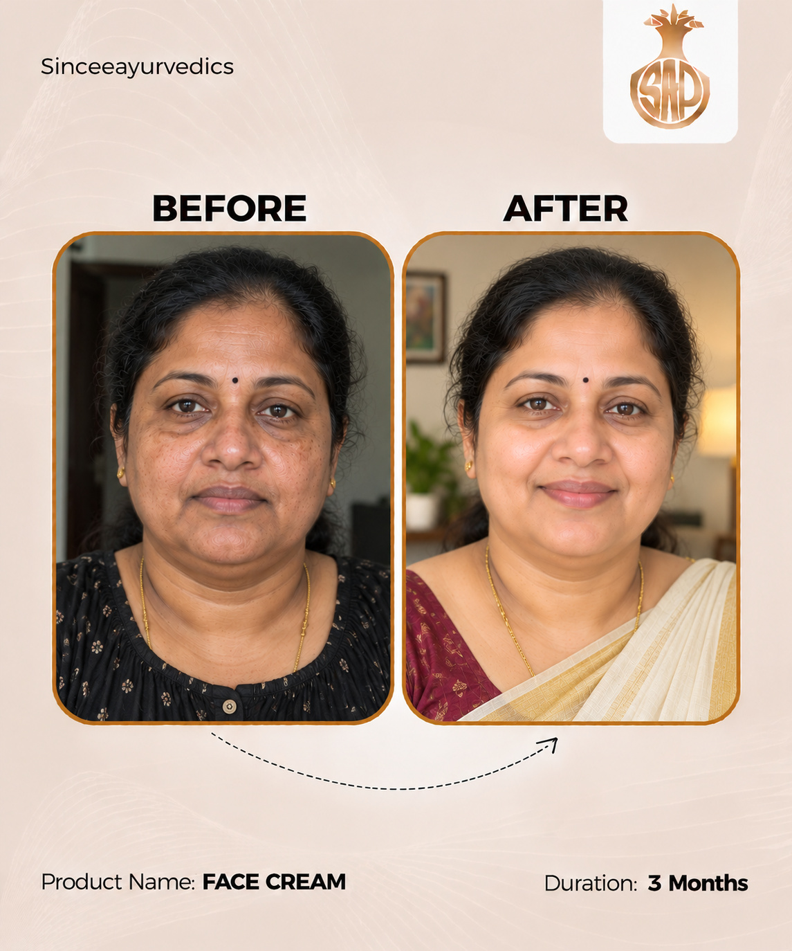 Chandrasudha Skin Nourish Combo