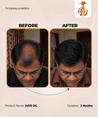 Chandrasudha Ayurvedic Regrow + Strengthen Hair Kit