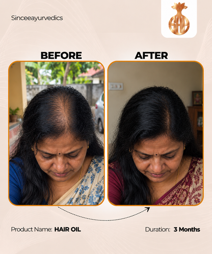 Chandrasudha Ayurvedic Regrow + Strengthen Hair Kit