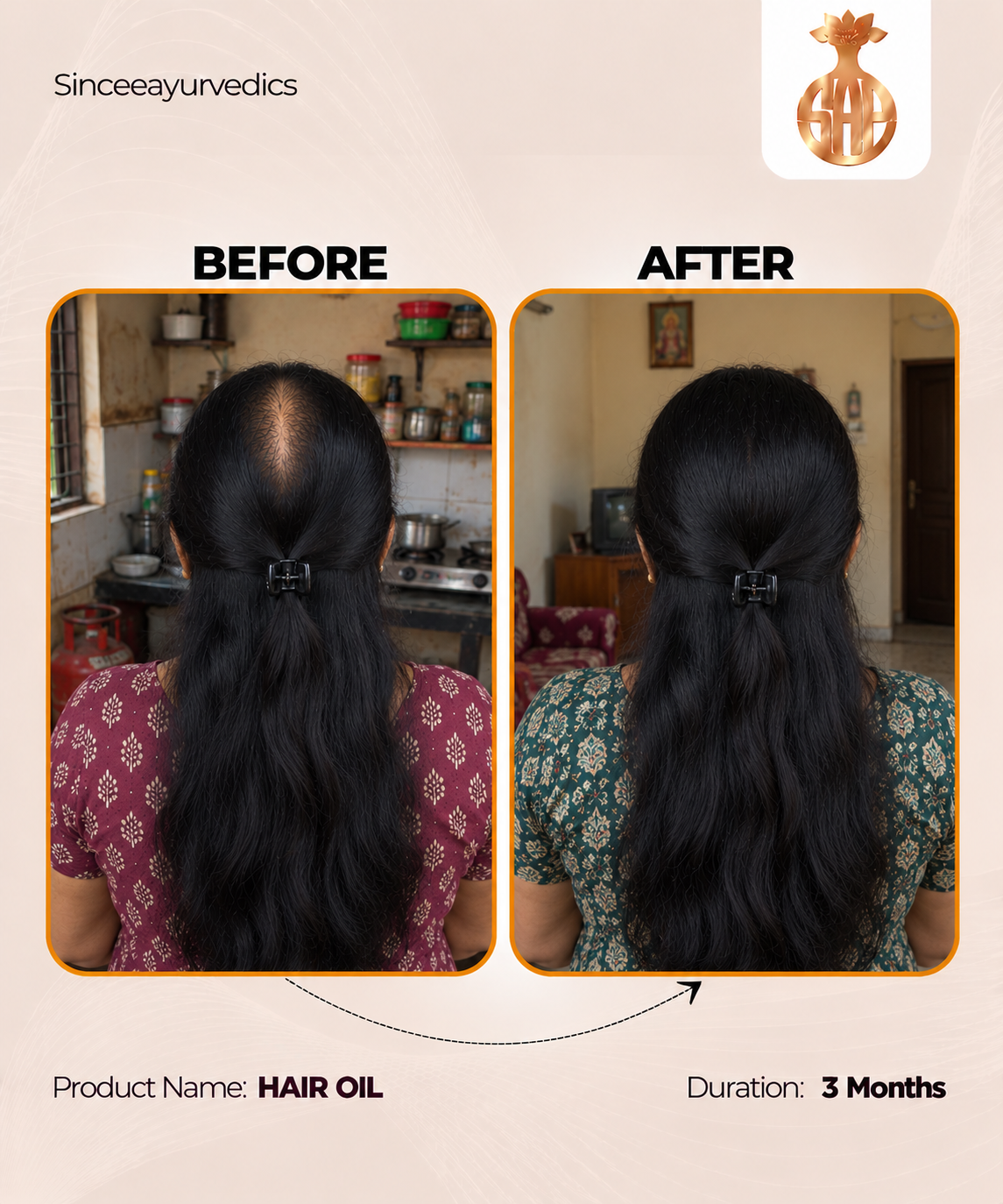 Chandrasudha Ayurvedic Regrow + Strengthen Hair Kit