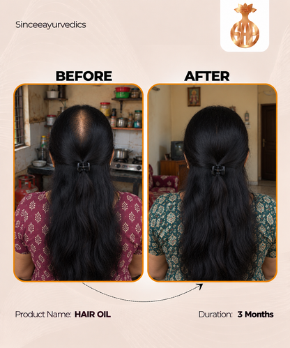 Chandrasudha Ayurvedic Regrow + Strengthen Hair Kit