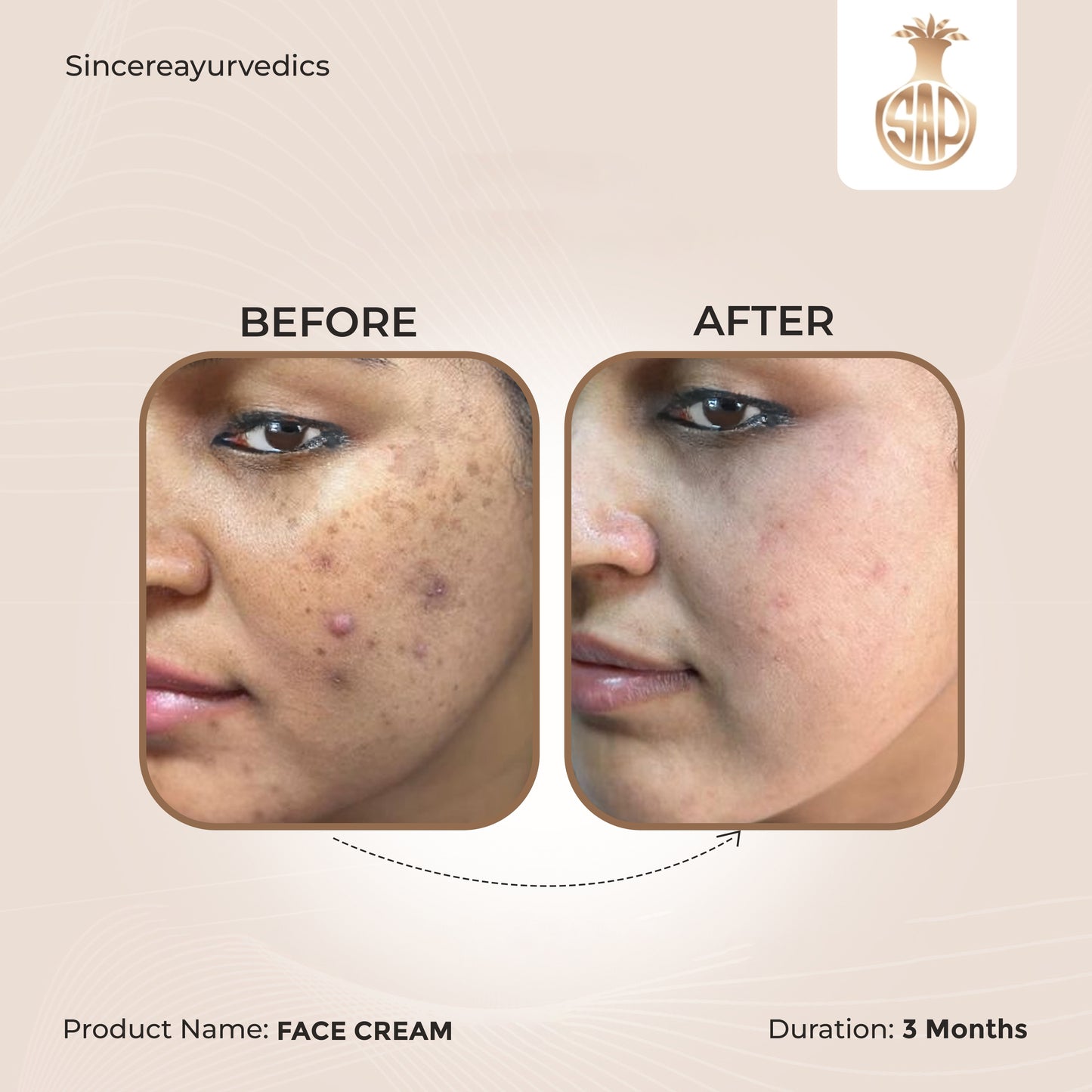 Chandrasudha Skin Care Duo