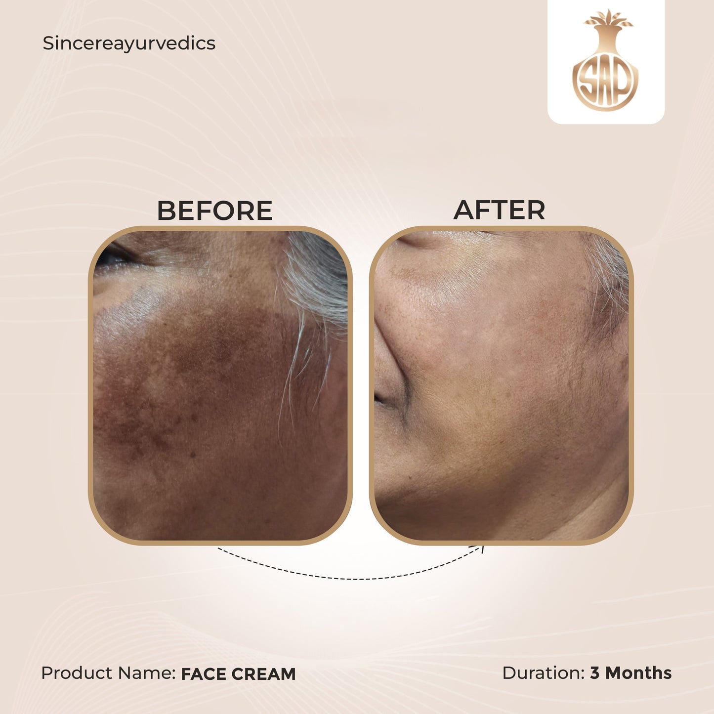 Chandrasudha Skin Nourish Combo