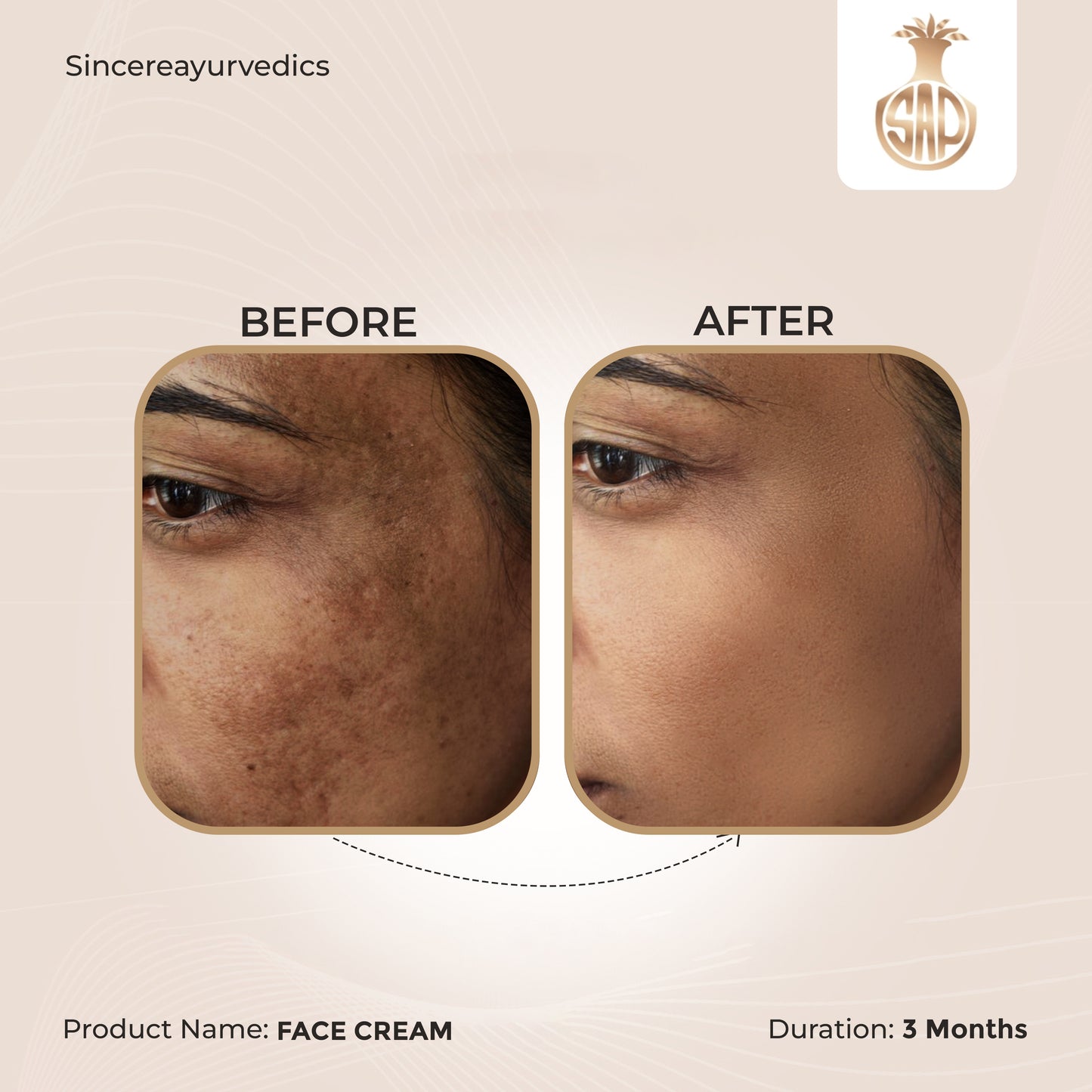 Chandrasudha Skin Care Duo